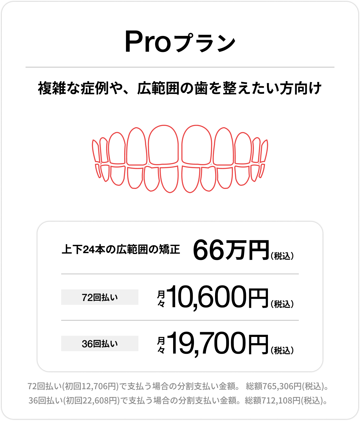Proプラン、上下前歯24本の部分矯正、66万円、月々（税込）10,600円〜