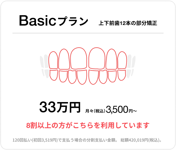 Basicプラン、上下前歯12本の部分矯正、33万円、月々(税込)3,500円〜