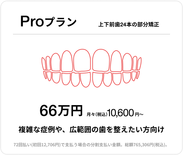 Proプラン、上下前歯24本の部分矯正、66万円、月々(税込)10,600円〜